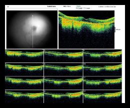 RADIAL LINE OD